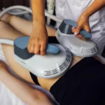 body contouring treatment on a womans abdomen and thighs using two aesthetic devices body contouring treatment on a womans abdomen and thighs using two aesthetic devices